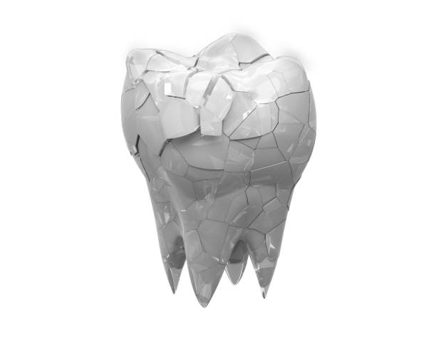 istock Broken glossy molars tooth isolated on white background. 3d illustration 1257352098