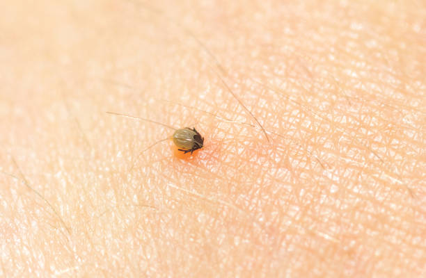 istock Little Ixodes ricinus bug on human skin suck blood 1257572335