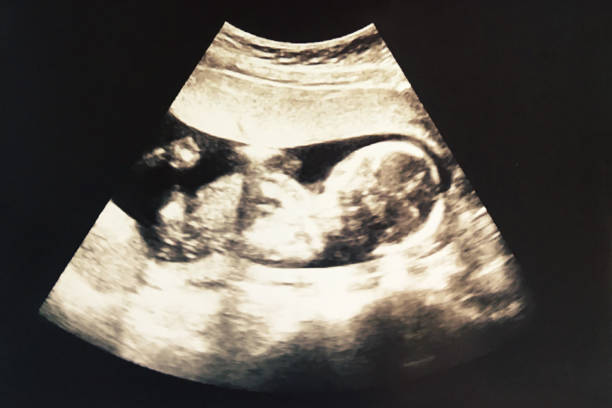 hand and people with body part 2D Ultrasound photo of infant baby in womb With age About 4 months Shows the shape of infant baby 3d scanning photos stock pictures, royalty-free photos & images