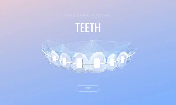 Vector illustration of Teeth with braces low poly banner template. Orthodontic treatment poster design. Correcting uneven teeth with brackets polygonal illustration. Innovative stomatology advertising typography