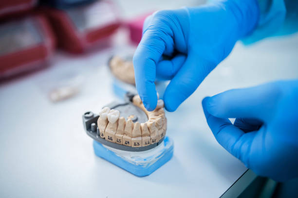 istock Model Of Dental Bridge To Replace Tooth. 1257674329