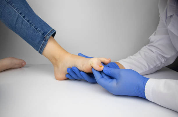 ein dermatologe untersucht einen von einem pilz betroffenen zehennagel. behandlung von mykose und unterstützung von patienten mit pilzerkrankungen. - toenail stock-fotos und bilder