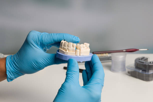 istock Dentist's hand in blue gloves with dental imprint with artificial dentition ready for use 1257731783