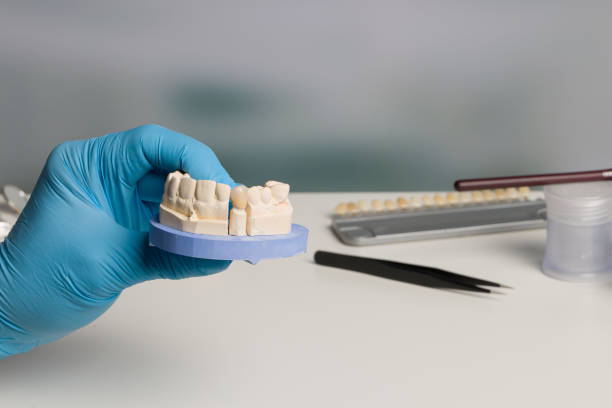 istock Dentist's hand in blue gloves with dental imprint with artificial dentition ready for use 1257731827