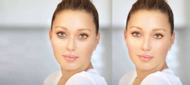 istock Eyelid surgery/Blepharoplasty,plastic surgeon,before and after 1257764882