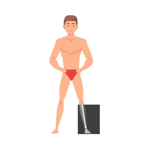 Vector illustration of Young Man Standing in Undershorts Doing His Leg Roentgen Vector Illustration