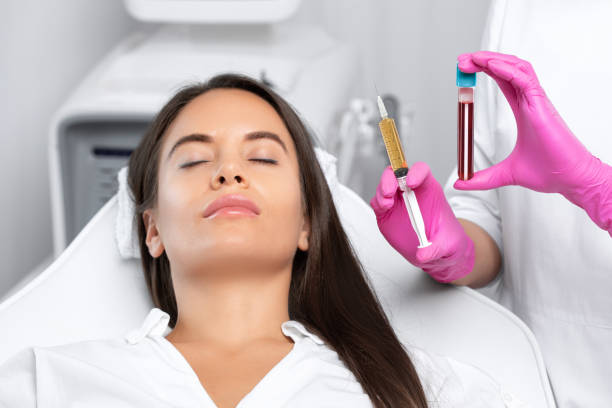 beautician will do prp therapy for the face against wrinkles and against hair loss of a beautiful woman in beauty salon.doctor holds test tubes with venous blood and blood plasma.cosmetology concept. - lifting device imagens e fotografias de stock