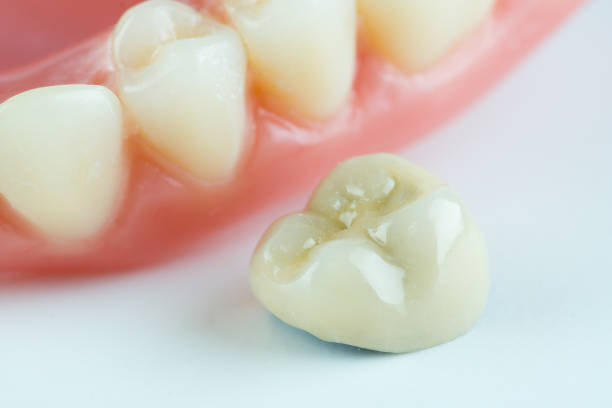 istock image of a modern denture nylone 1258140393