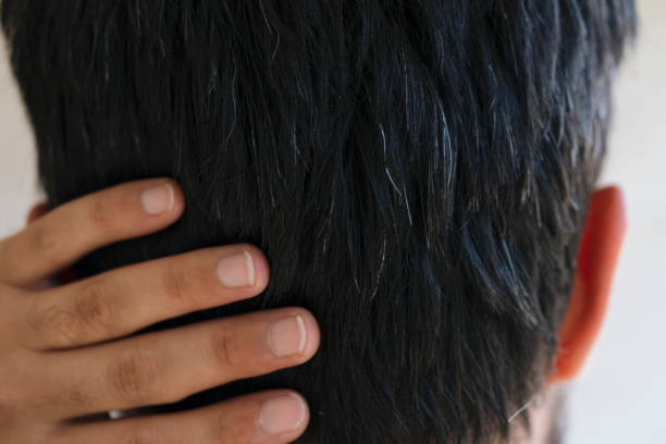 il giovane sta invecchiando ora e i suoi capelli si sta sbiancando - white hair foto e immagini stock