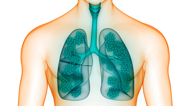 肺胞解剖学を用いたヒト呼吸器系肺 - human lung tuberculosis bacterium emphysema human trachea ストックフォトと画像