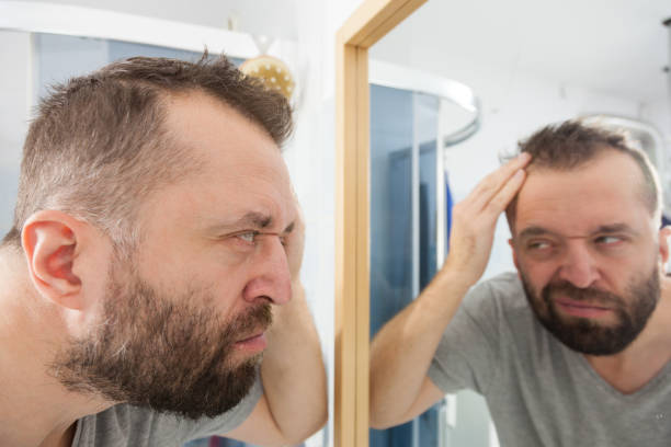 istock Worried man looking at his decreasing hairline 1259811405
