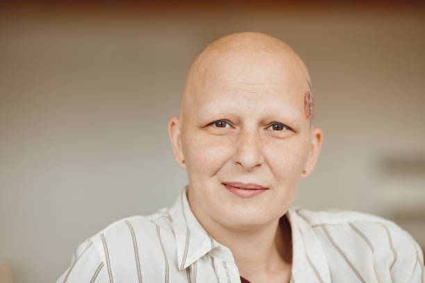 istock Modern Bald Woman Smiling at Camera 1260017854