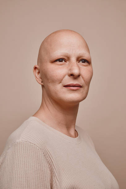 verticale minimale de femme chauve dans le studio - shaved head photos et images de collection