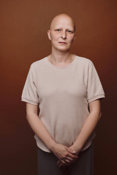 istock Mature Bald Woman in Studio 1260018993