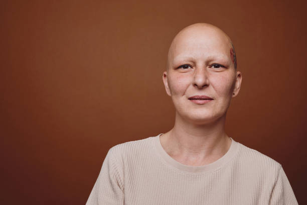istock Studio Portrait of Smiling Bald Woman 1260018995