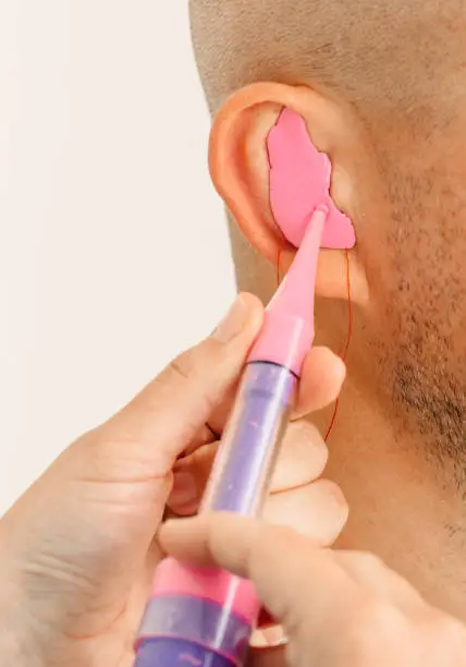 Photo of Process of making earplug from an impression of an individual s human ear. Ear close-up. Personally molded earplugs. Solution for noisy places. Part of the set