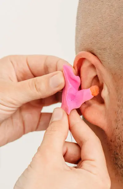 Photo of Process of making earplug from an impression of an individual s human ear. Ear close-up. Personally molded earplugs. Solution for noisy places. Part of the set