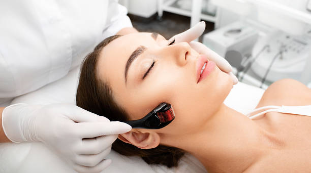 Beautician doing skin treatment using a microneedle derma roller. Woman getting procedure skincare, with mezzo skin roller Beautician doing skin treatment using a microneedle derma roller. Woman getting procedure skincare, with mezzo skin roller environmental regeneration photos stock pictures, royalty-free photos & images