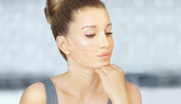 istock thread lift , nonsurgical procedure,lower facelift 1261244993