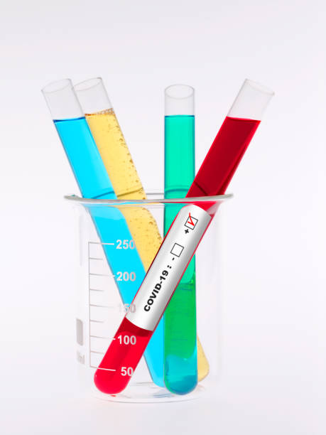 istock Covid-19 Test Tube With Blood 1261941759