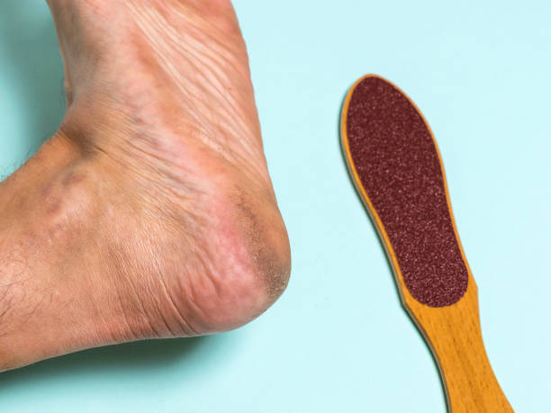 istock Brush for removing rough skin and the man's left leg. 1262083886