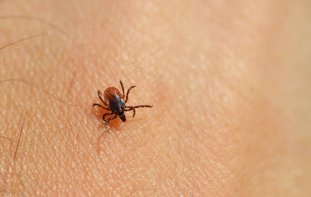 istock Tick ( Ixodes ricinus ) on human skin. 1262189572