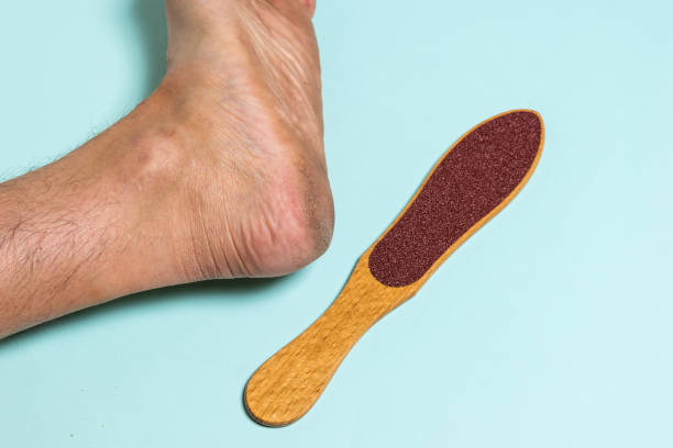 istock Manual device for removing rough skin and the man's left leg. 1262541370