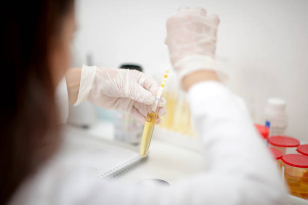 istock Wearing protective gloves and measuring urine pH with test strip 1262689019