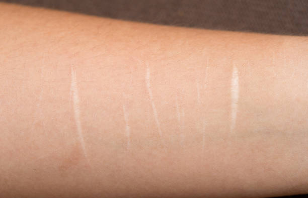 Hand with cuts Hand with cuts after suicide attempt scab arm stock pictures, royalty-free photos & images