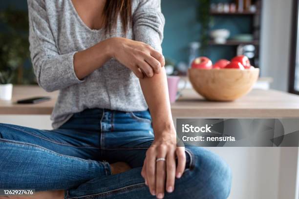 Young Woman Scratching Her Arm While Sitting On The Stool In The Home Kitchen Stock Photo - Download Image Now