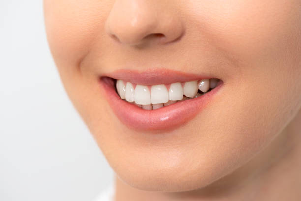 istock Teeth whitening, perfect smile 1263025153