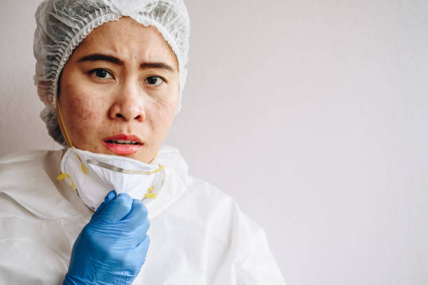 pracownik służby zdrowia z trądzikiem i ranami twarzy występują z maski medycznej po pracy dla wieloletniego w szpitalu podczas covid-19 pandemii. - longtime zdjęcia i obrazy z banku zdjęć