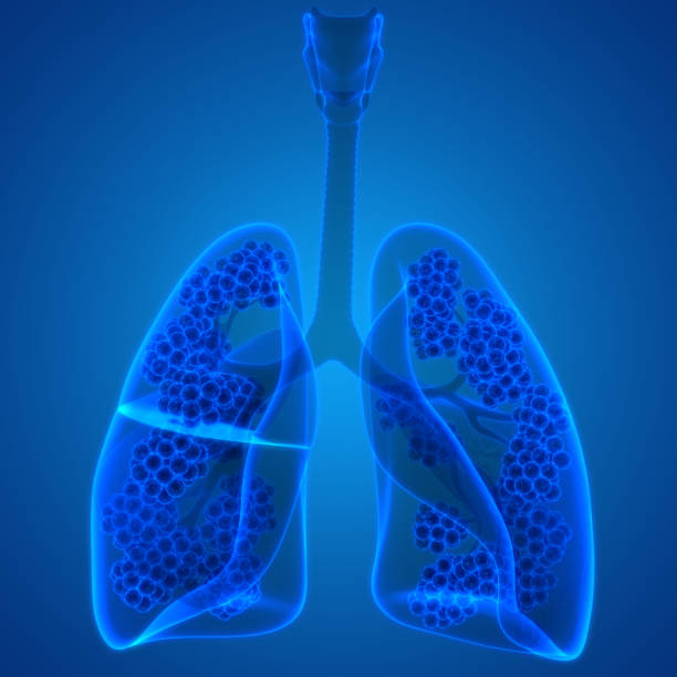 istock Human Respiratory System Lungs with Alveoli Anatomy 1263072615
