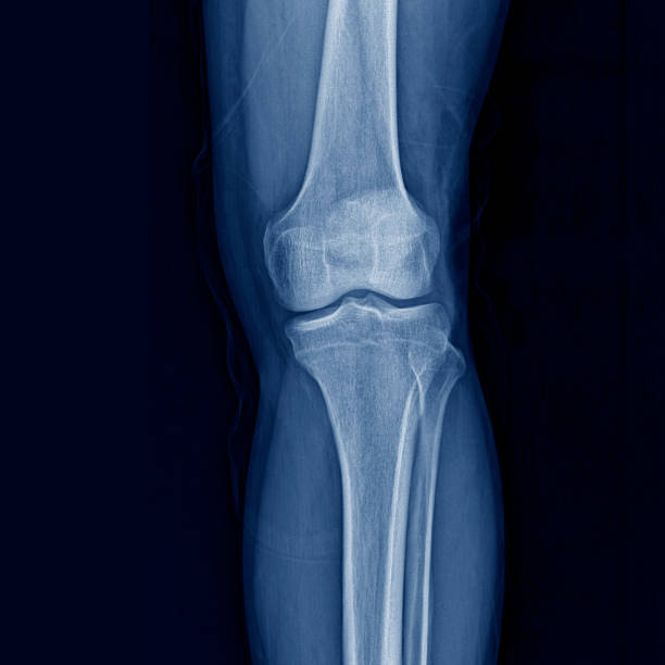 istock Sporting injury stock photo 1263101965