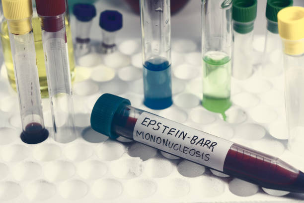 Mononucleosis and Epstein-barr virus blood test sample in lab on the white background Mononucleosis and Epstein-barr virus blood test sample in lab on the white background epstein barr virus photos stock pictures, royalty-free photos & images