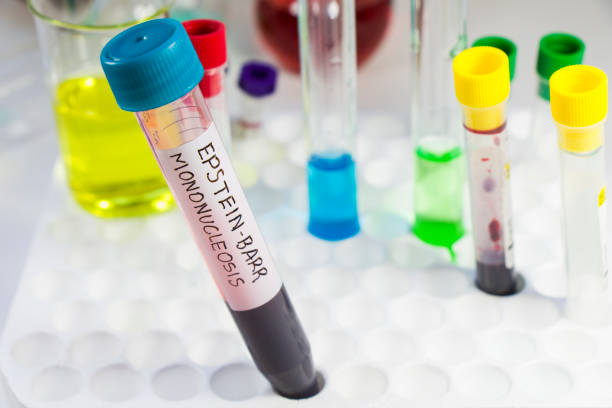 istock Mononucleosis and Epstein-barr virus blood test sample in lab on the white background 1263129178