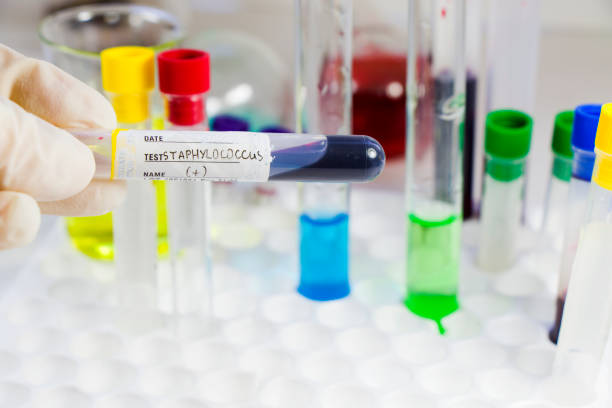 istock Staphylococci bacteria, blood test tube samples 1263129243