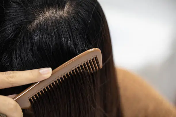 Photo of Problem of Young woman hair loss, with thin hair.