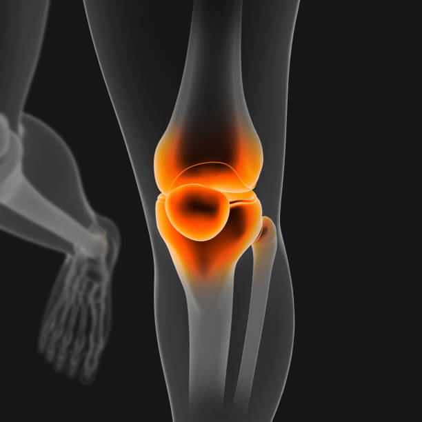 istock 3D_Illustration_Knee_painful_human_skeleton_medical_concept_front_angle 1263376556