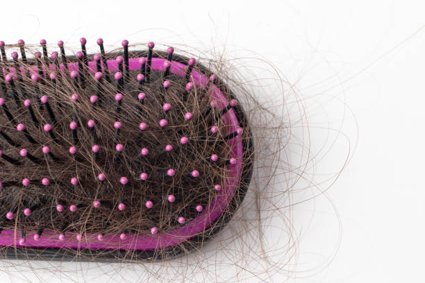 istock Hair loss on a comb on a white background. Baldness. 1263620132