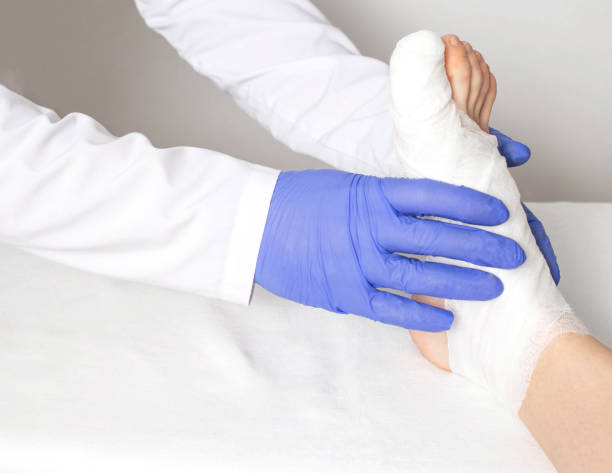 An orthopedic doctor examines a bruised toe. Big toe sprain and fracture concept, close-up, medical, copy space An orthopedic doctor examines a bruised toe. Big toe sprain and fracture concept, close-up, medical a hematoma pictures stock pictures, royalty-free photos & images