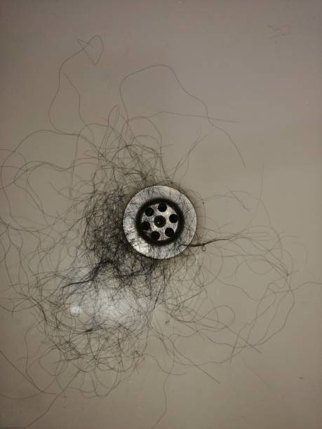 istock Hair loss 1263880797