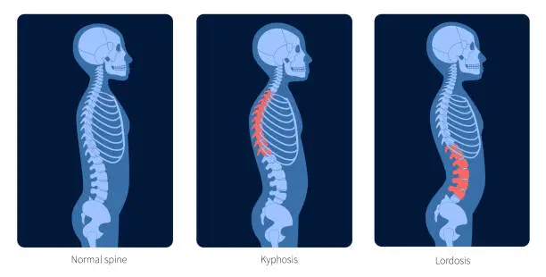 Vector illustration of Spine X ray