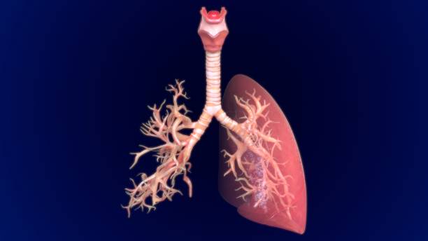 istock 3D Illustration Human Lungs Anatomy (Bronchi, Bronchioles) 1264198627