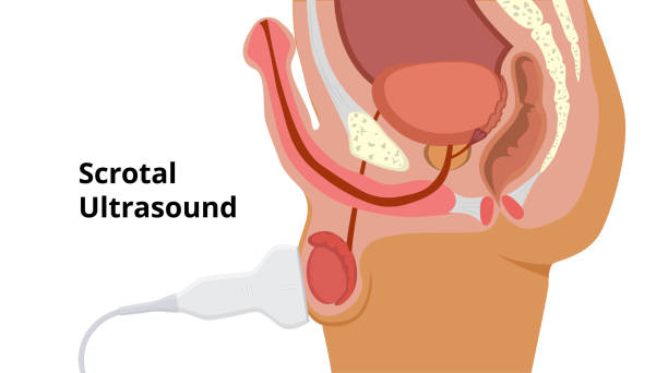istock Scrotal ultrasound scan process. Male roproductive system anatomy and examination 1264379023