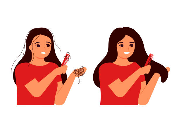 Girl combs her hair, hair on comb, fall. Hair loss, baldness, fragility, alopecia concept. Hair before and after. Woman s thin hair is associated with problem, stress, hormones, nutrition. Vector Girl combs her hair, hair on comb, fall. Hair loss, baldness, alopecia concept. Woman s thin hair is associated with problem, stress, hormones, nutrition. Vector flat illustration anticipation illustrations stock illustrations