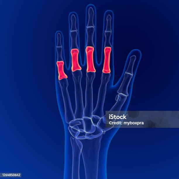 Falanges Netter Foto de Anatomia Do Esqueleto Humano Falanges Proximal Ossos 3d ...