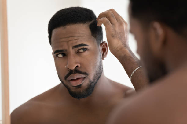 Close up anxious unhappy African American man checking hair Close up anxious unhappy African American man checking hair after shower, looking in mirror, standing in bathroom at home, dissatisfied by hair loss or dandruff, healthcare and beauty concept dandruff men stock pictures, royalty-free photos & images