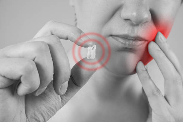 Wisdom tooth extraction, man suffering from a toothache Wisdom tooth extraction, man suffering from a toothache, painful area highlighted in red wisdom-teeth stock pictures, royalty-free photos & images