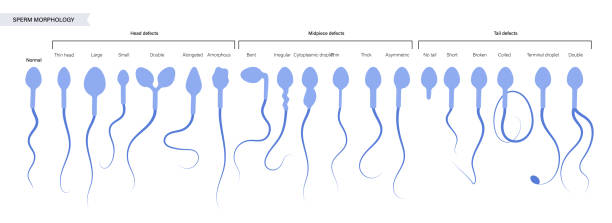 Human fertility Sperm morphology and ivf research concept. Normal, abnormal and defective human egg. Spermatozoon flat vector illustration. Human sexual reproductive system. Diagram for clinic and education sperm stock illustrations